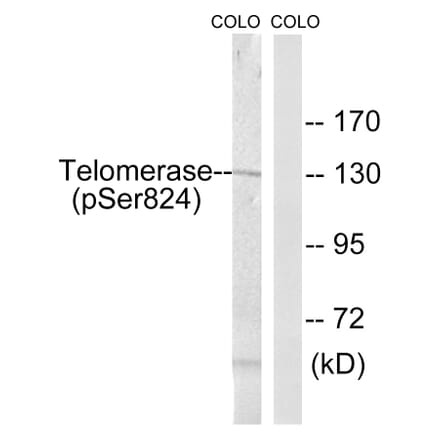 Western Blot - Anti-Telomerase (phospho Ser824) Antibody (A1183) - Antibodies.com