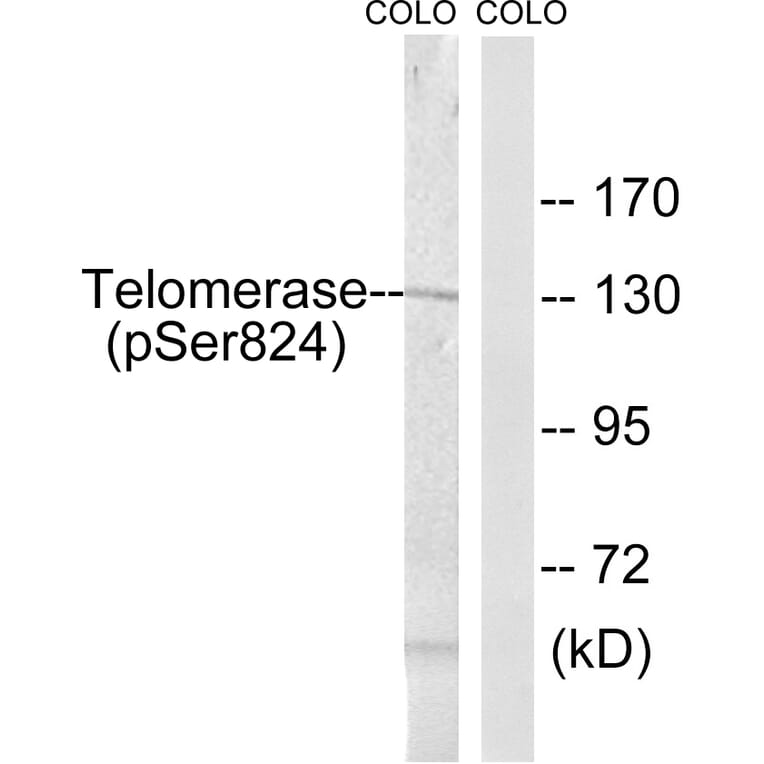 Western Blot - Anti-Telomerase (phospho Ser824) Antibody (A1183) - Antibodies.com