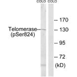 Western Blot - Anti-Telomerase (phospho Ser824) Antibody (A1183) - Antibodies.com