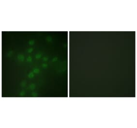 Immunofluorescence - Anti-Telomerase (phospho Ser227) Antibody (A1182) - Antibodies.com