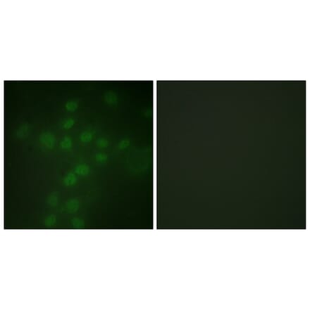 Immunofluorescence - Anti-Telomerase (phospho Ser227) Antibody (A1182) - Antibodies.com
