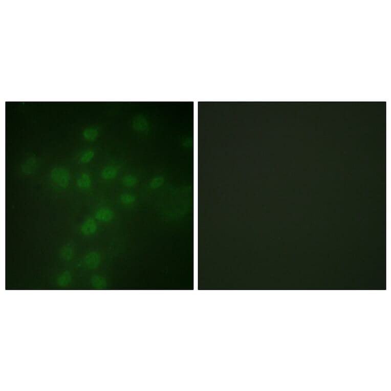 Immunofluorescence - Anti-Telomerase (phospho Ser227) Antibody (A1182) - Antibodies.com