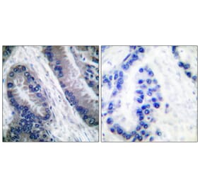 Immunohistochemistry - Anti-IL-1 beta (cleaved Asp210) Antibody (L0115) - Antibodies.com