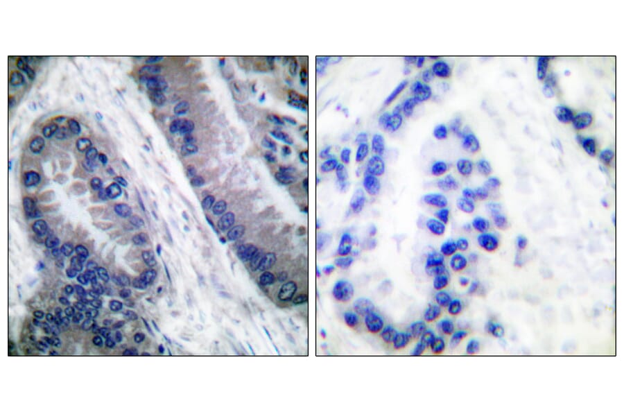 Immunohistochemistry - Anti-IL-1 beta (cleaved Asp210) Antibody (L0115) - Antibodies.com