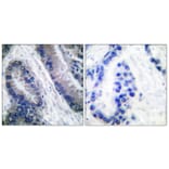 Immunohistochemistry - Anti-IL-1 beta (cleaved Asp210) Antibody (L0115) - Antibodies.com