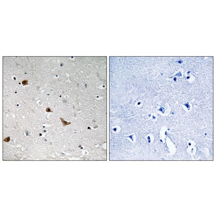 Immunohistochemistry - Anti-IKK-gamma (phospho Ser376) Antibody (A8114) - Antibodies.com