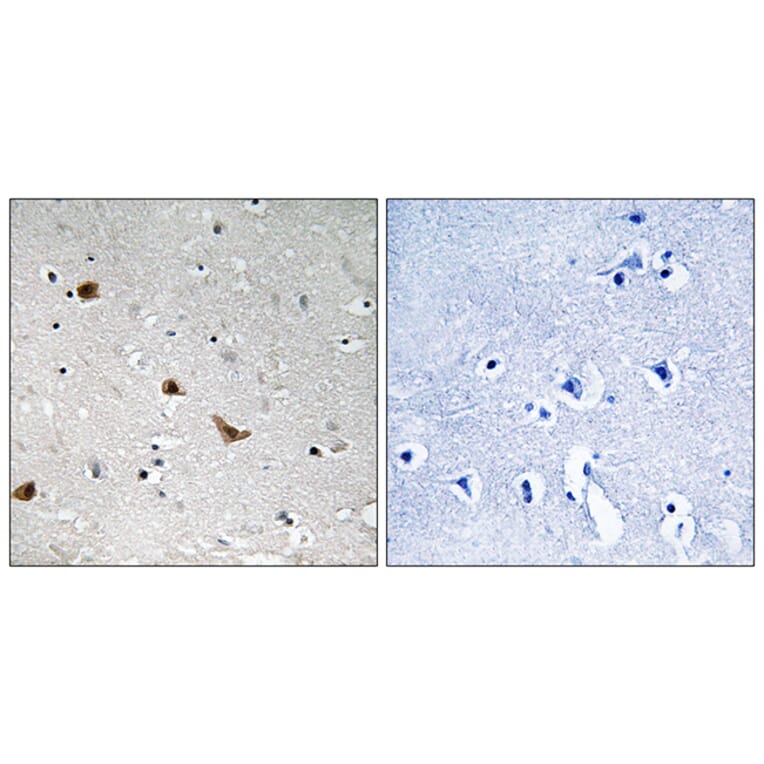 Immunohistochemistry - Anti-IKK-gamma (phospho Ser376) Antibody (A8114) - Antibodies.com