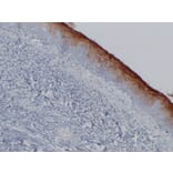 Immunohistochemistry - Anti-Carcinoembryonic Antigen Antibody (V0041) - Antibodies.com