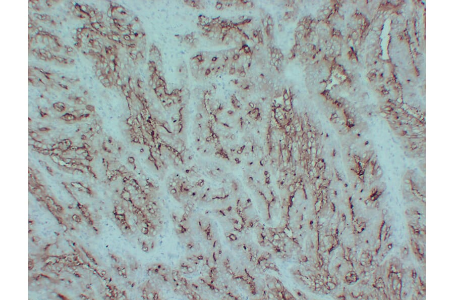 Immunohistochemistry - Anti-Carcinoembryonic Antigen Antibody (V0041) - Antibodies.com