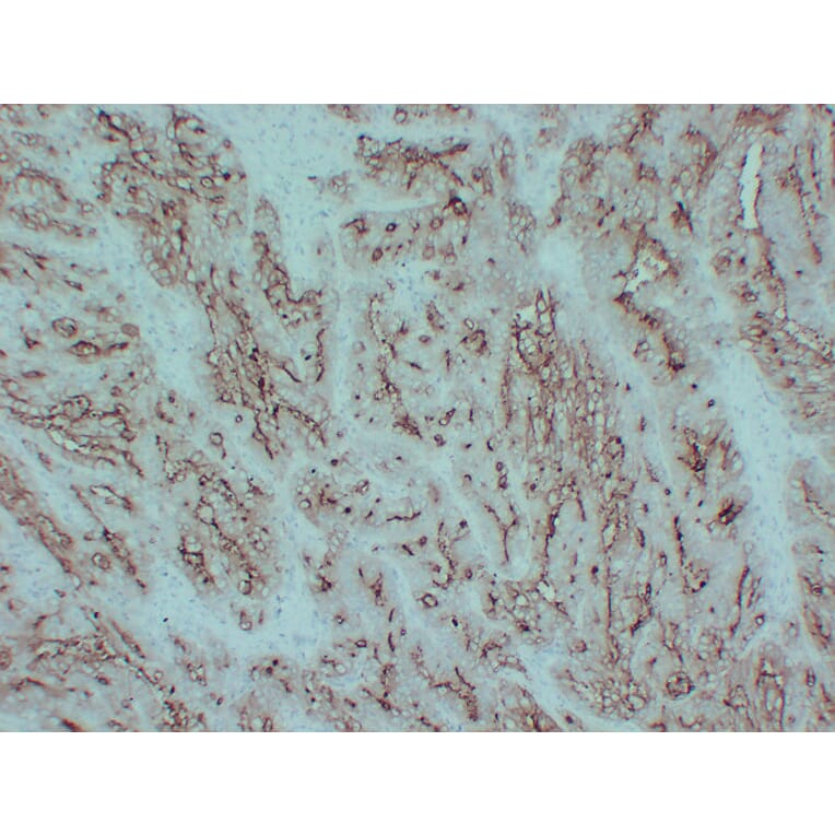 Immunohistochemistry - Anti-Carcinoembryonic Antigen Antibody (V0041) - Antibodies.com