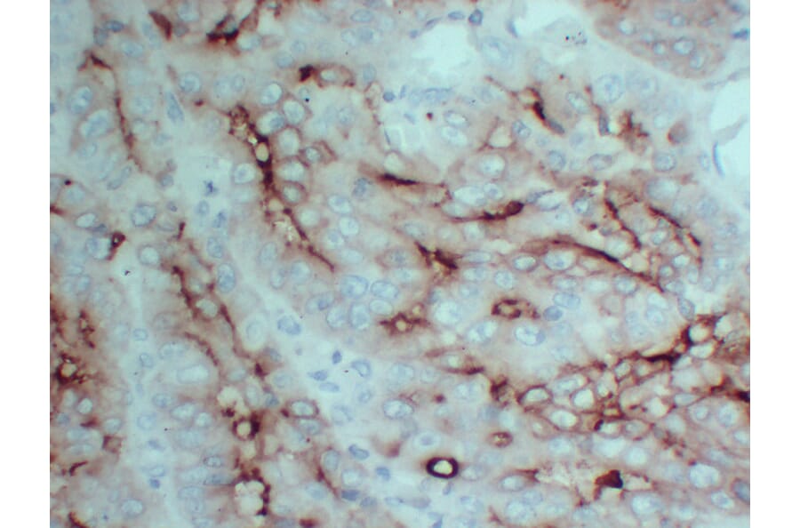 Immunohistochemistry - Anti-Carcinoembryonic Antigen Antibody (V0041) - Antibodies.com