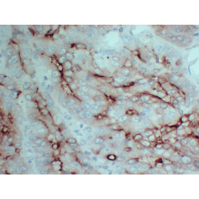 Immunohistochemistry - Anti-Carcinoembryonic Antigen Antibody (V0041) - Antibodies.com