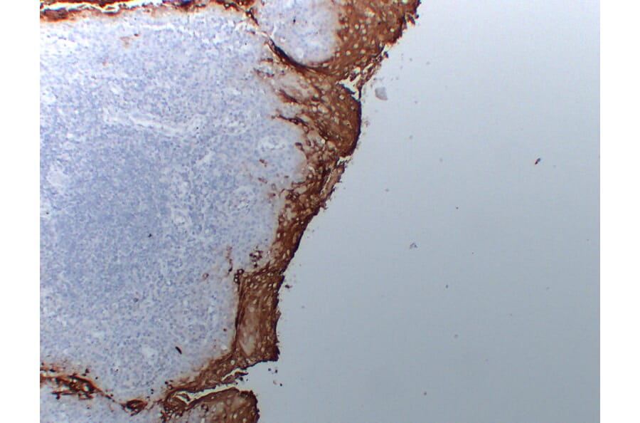 Immunohistochemistry - Anti-Carcinoembryonic Antigen Antibody (V0041) - Antibodies.com