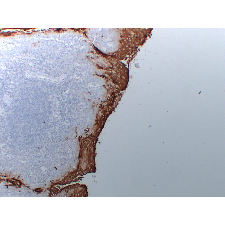 Immunohistochemistry - Anti-Carcinoembryonic Antigen Antibody (V0041) - Antibodies.com