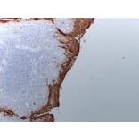 Immunohistochemistry - Anti-Carcinoembryonic Antigen Antibody (V0041) - Antibodies.com