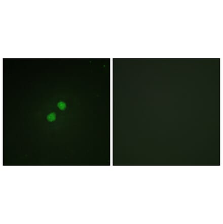 Immunofluorescence - Anti-Nibrin (phospho Ser278) Antibody (A1221) - Antibodies.com