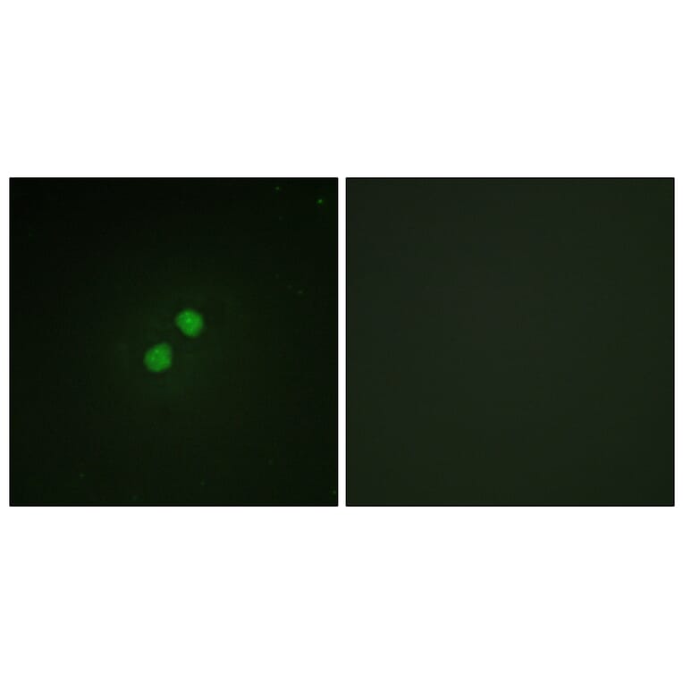 Immunofluorescence - Anti-Nibrin (phospho Ser278) Antibody (A1221) - Antibodies.com