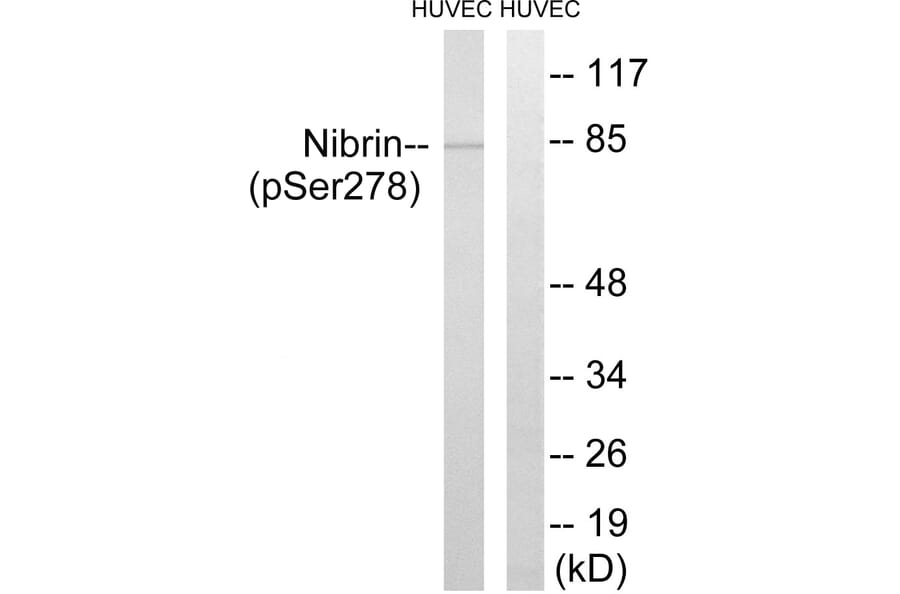 Western Blot - Anti-Nibrin (phospho Ser278) Antibody (A1221) - Antibodies.com