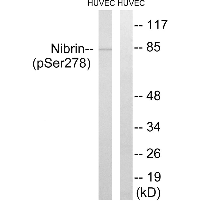 Western Blot - Anti-Nibrin (phospho Ser278) Antibody (A1221) - Antibodies.com