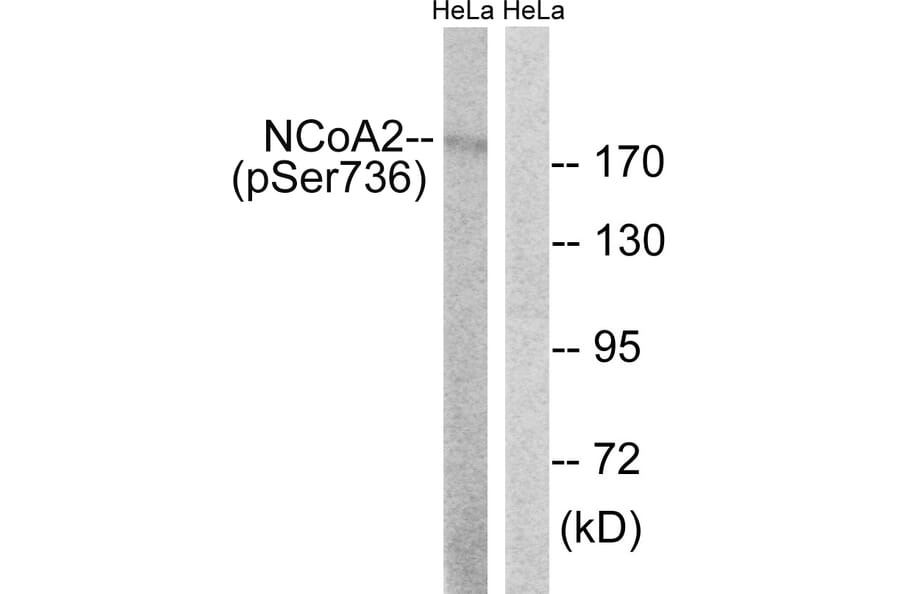 Western Blot - Anti-NCoA2 (phospho Ser736) Antibody (A8381) - Antibodies.com