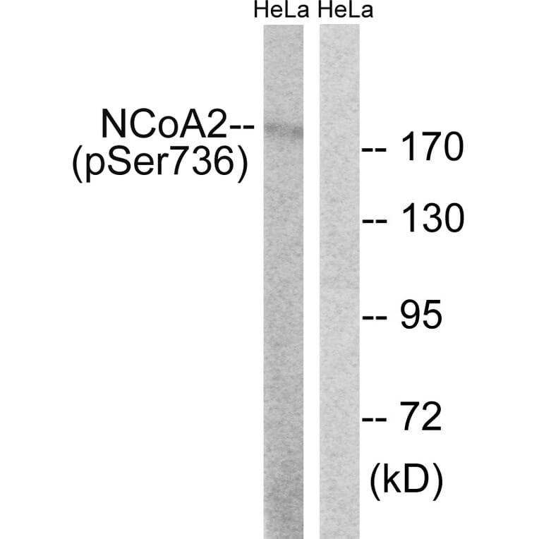 Western Blot - Anti-NCoA2 (phospho Ser736) Antibody (A8381) - Antibodies.com