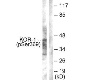 Western Blot - Anti-KOR-1 (phospho Ser369) Antibody (A0448) - Antibodies.com