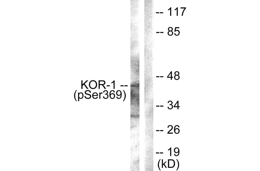 Western Blot - Anti-KOR-1 (phospho Ser369) Antibody (A0448) - Antibodies.com
