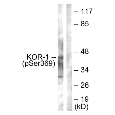 Western Blot - Anti-KOR-1 (phospho Ser369) Antibody (A0448) - Antibodies.com