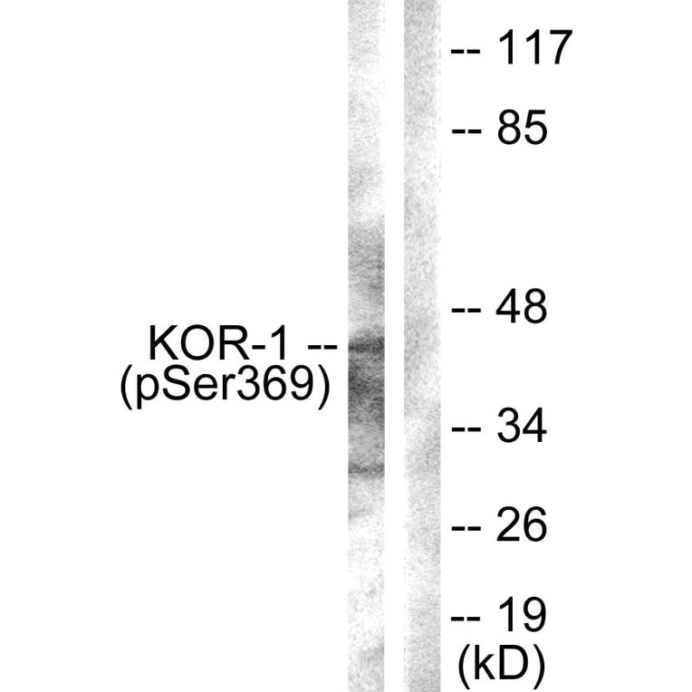 Western Blot - Anti-KOR-1 (phospho Ser369) Antibody (A0448) - Antibodies.com