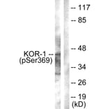 Western Blot - Anti-KOR-1 (phospho Ser369) Antibody (A0448) - Antibodies.com