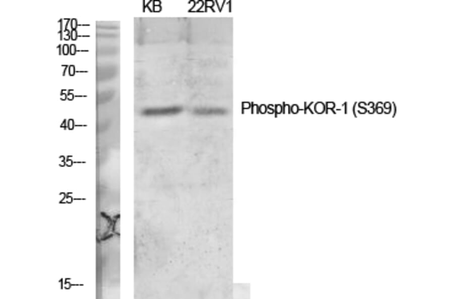 Western Blot - Anti-KOR-1 (phospho Ser369) Antibody (A0448) - Antibodies.com