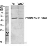 Western Blot - Anti-KOR-1 (phospho Ser369) Antibody (A0448) - Antibodies.com