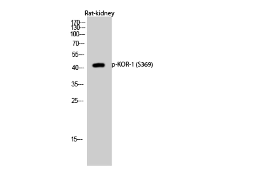 Western Blot - Anti-KOR-1 (phospho Ser369) Antibody (A0448) - Antibodies.com