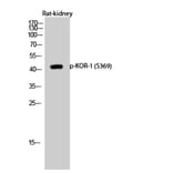 Western Blot - Anti-KOR-1 (phospho Ser369) Antibody (A0448) - Antibodies.com