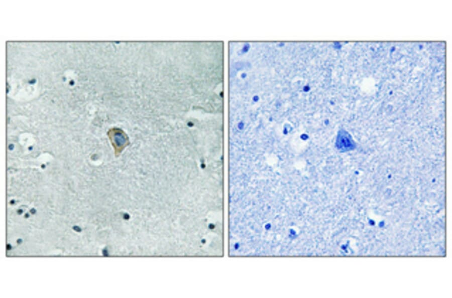 Immunohistochemistry - Anti-KOR-1 (phospho Ser369) Antibody (A0448) - Antibodies.com