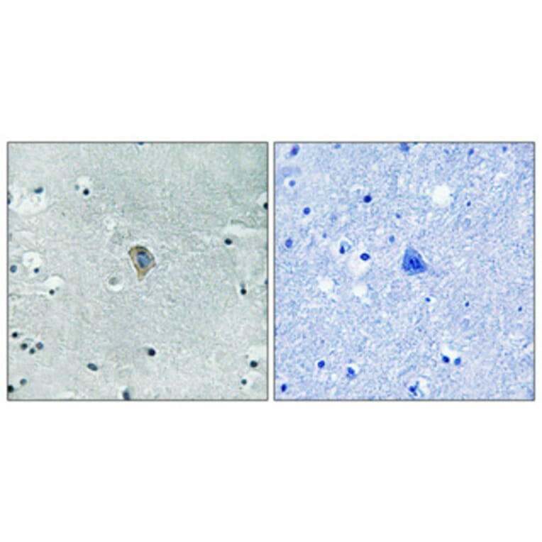 Immunohistochemistry - Anti-KOR-1 (phospho Ser369) Antibody (A0448) - Antibodies.com