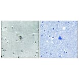 Immunohistochemistry - Anti-KOR-1 (phospho Ser369) Antibody (A0448) - Antibodies.com
