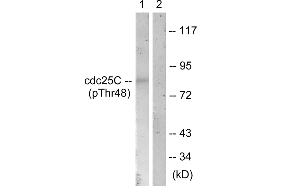 Western Blot - Anti-CDC25C (phospho Thr48) Antibody (A0628) - Antibodies.com