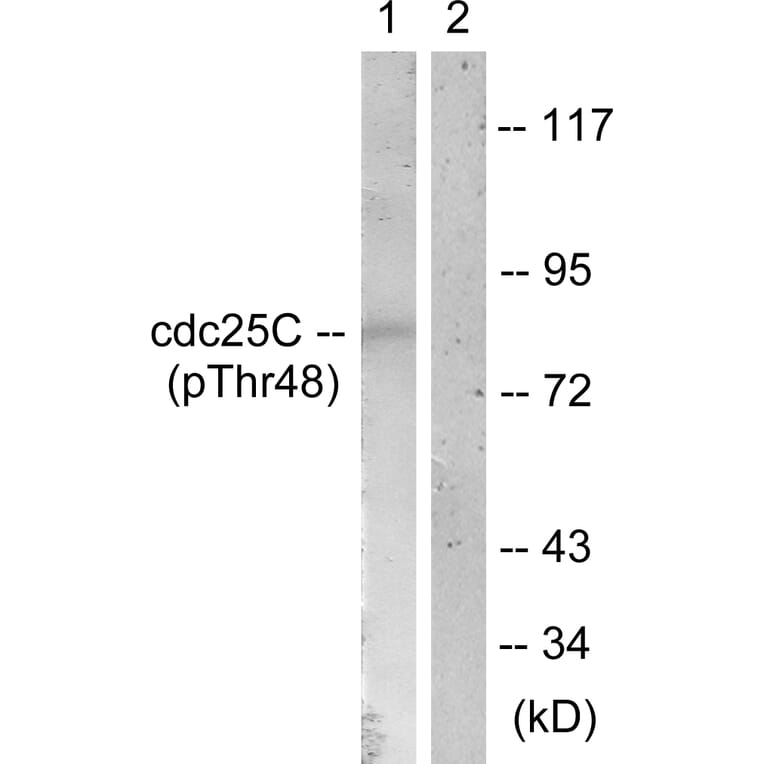 Western Blot - Anti-CDC25C (phospho Thr48) Antibody (A0628) - Antibodies.com