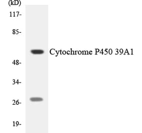 Western Blot - Anti-Cytochrome P450 39A1 Antibody (R12-2681) - Antibodies.com