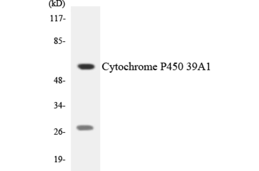 Western Blot - Anti-Cytochrome P450 39A1 Antibody (R12-2681) - Antibodies.com