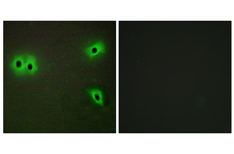 Immunofluorescence - Anti-Collagen XIII alpha1 Antibody (C12217) - Antibodies.com