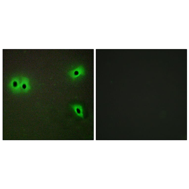 Immunofluorescence - Anti-Collagen XIII alpha1 Antibody (C12217) - Antibodies.com