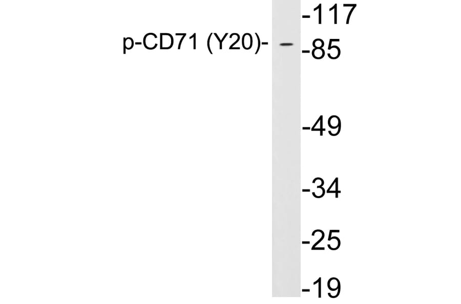 Western Blot - Anti-CD71 (phospho Tyr20) Antibody (P12-1012) - Antibodies.com