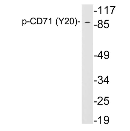 Western Blot - Anti-CD71 (phospho Tyr20) Antibody (P12-1012) - Antibodies.com