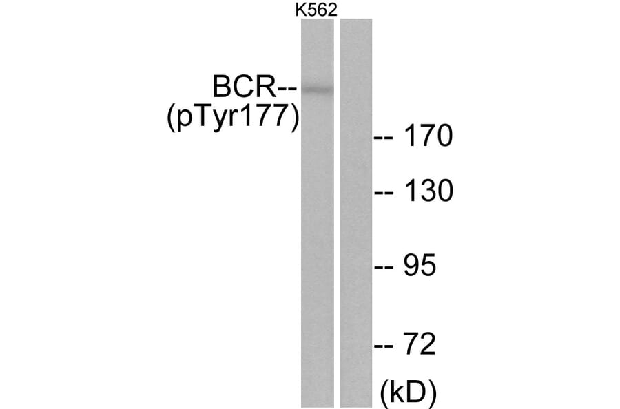Western Blot - Anti-Bcr (phospho Tyr177) Antibody (A7028) - Antibodies.com