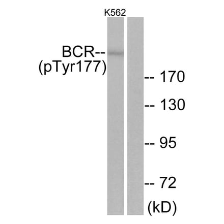 Western Blot - Anti-Bcr (phospho Tyr177) Antibody (A7028) - Antibodies.com