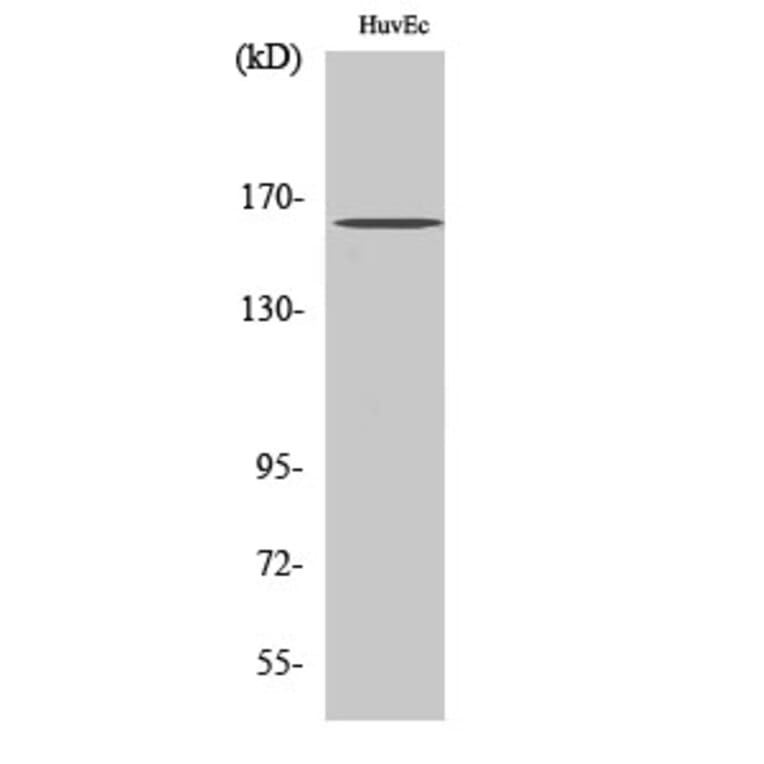 Western Blot - Anti-Bcr (phospho Tyr177) Antibody (A7028) - Antibodies.com