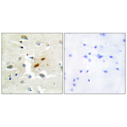 Immunohistochemistry - Anti-DNA Polymerase zeta Antibody (C10144) - Antibodies.com