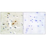 Immunohistochemistry - Anti-DNA Polymerase zeta Antibody (C10144) - Antibodies.com